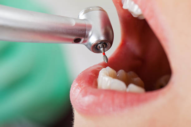 Best Emergency Gum Pain Relief  in Ferndale, CA